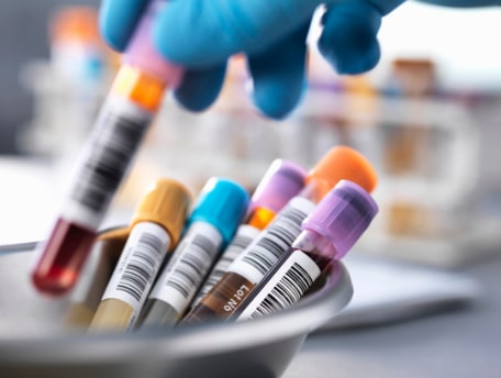 Producing pilot runs and clinical samples